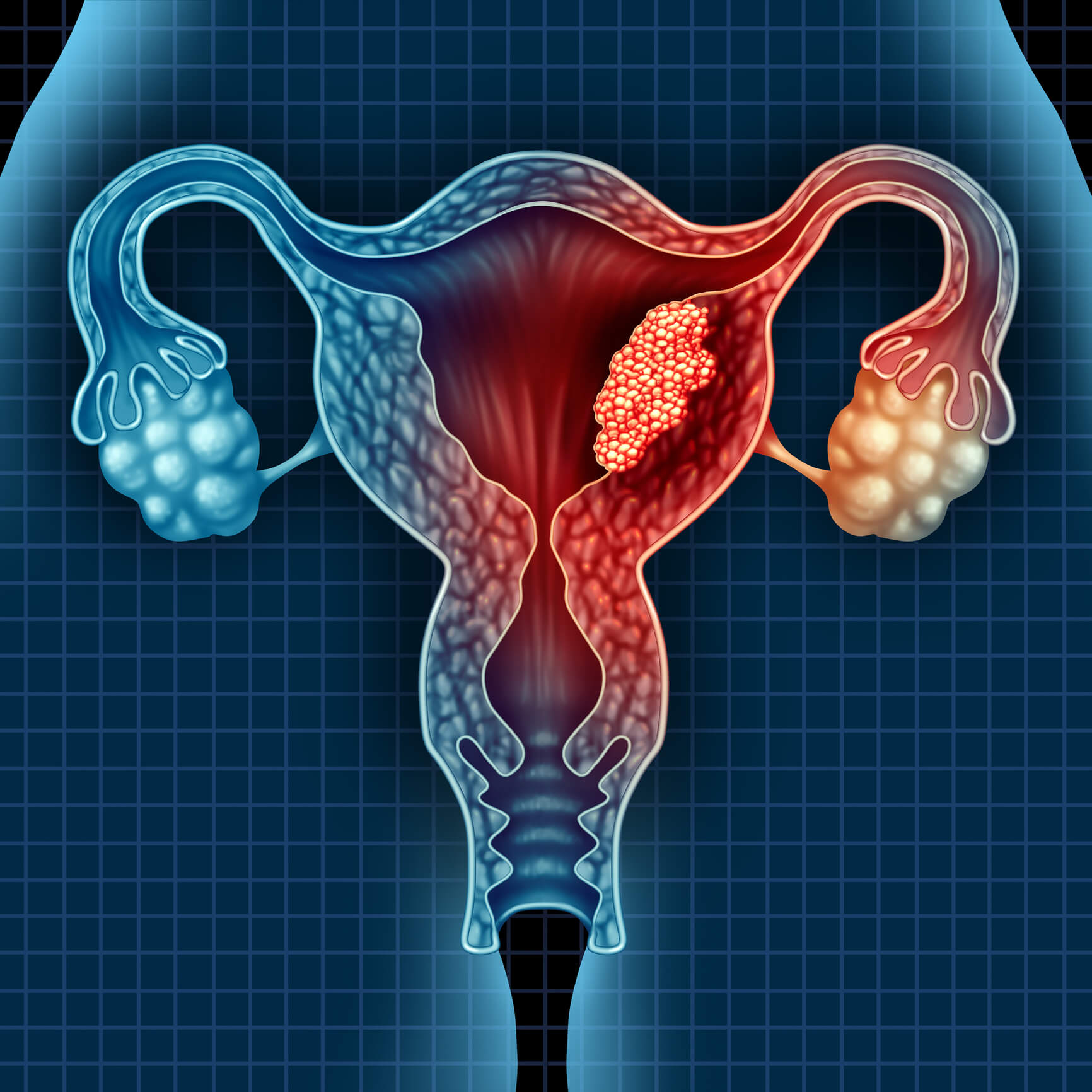 Gynecological & Urogenital Health